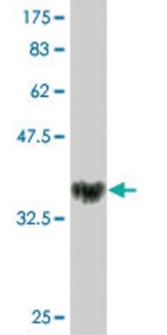 Monoclonal Anti-NOVA1, (C-terminal) antibody produced in mouse