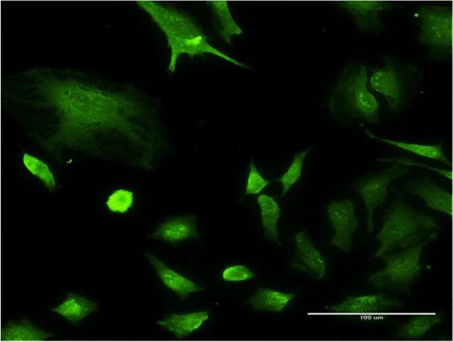 Monoclonal Anti-NPM1 antibody produced in mouse