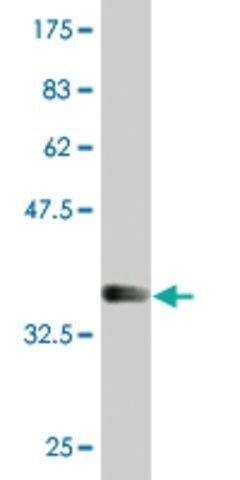 Monoclonal Anti-LSM1, (C-terminal) antibody produced in mouse