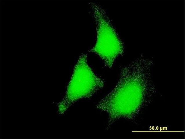 Monoclonal Anti-MAP2K5 antibody produced in mouse