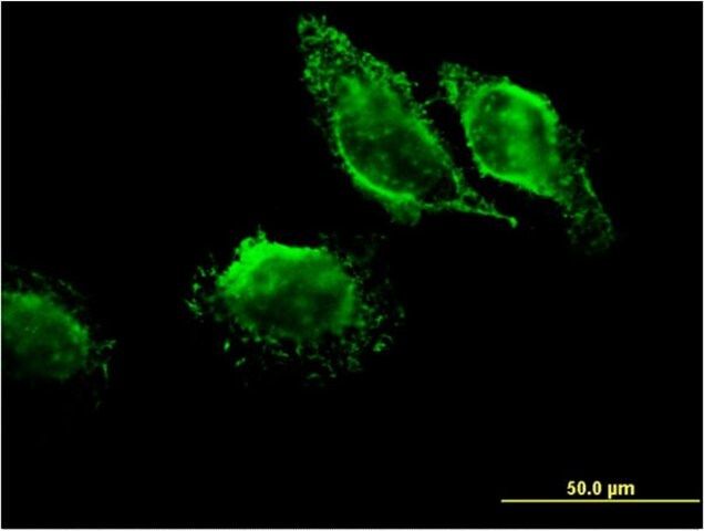 Monoclonal Anti-MAPRE3 antibody produced in mouse