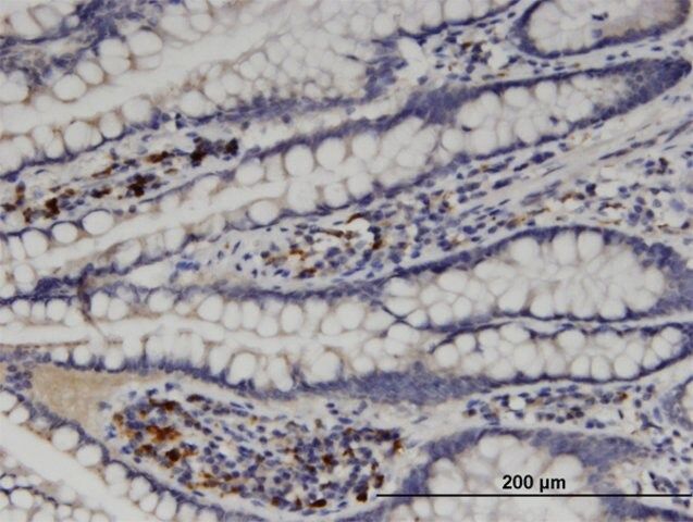 Monoclonal Anti-MGAT5 antibody produced in mouse