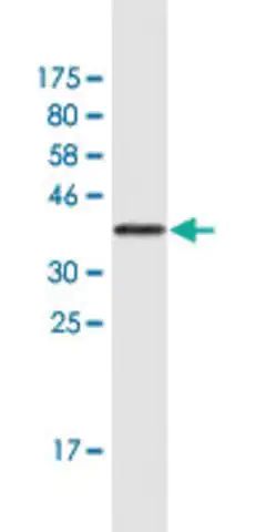 Monoclonal Anti-MLL2 antibody produced in mouse