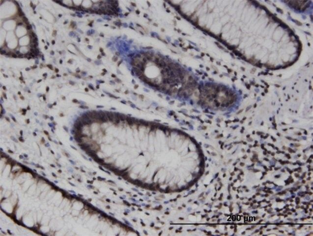 Monoclonal Anti-MLKL, (C-terminal) antibody produced in mouse