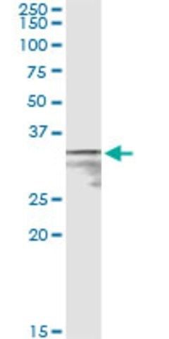 Monoclonal Anti-MPST antibody produced in mouse