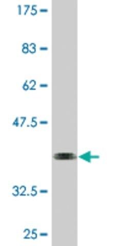 Monoclonal Anti-HSFY1, (N-terminal) antibody produced in mouse