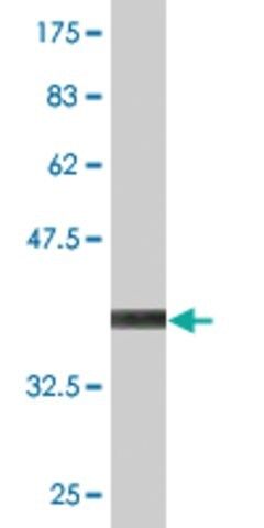 Monoclonal Anti-DPYSL5 antibody produced in mouse