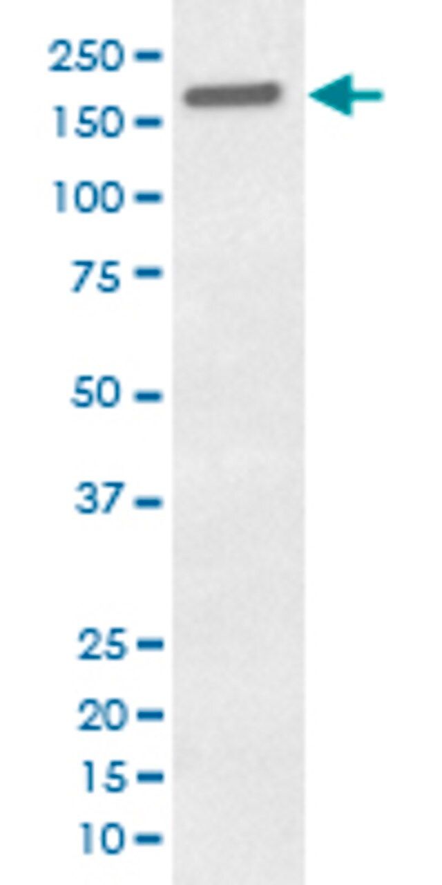 Monoclonal Anti-EGFR (phospho Y1173) antibody produced in rabbit