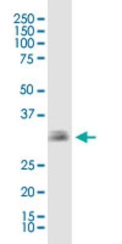 Monoclonal Anti-EBAG9 antibody produced in mouse