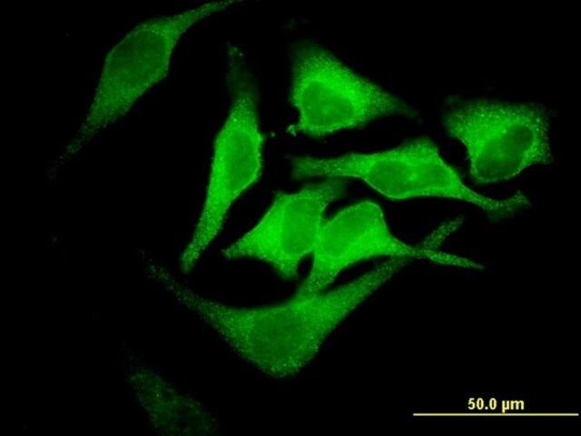 Monoclonal Anti-EPB42, (C-terminal) antibody produced in mouse