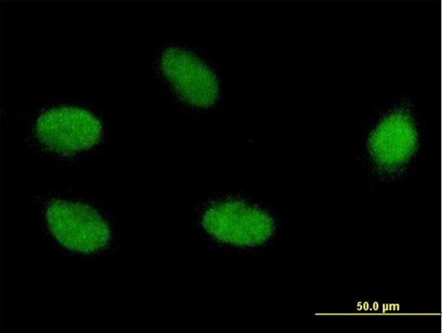 Monoclonal Anti-ELAC2 antibody produced in mouse