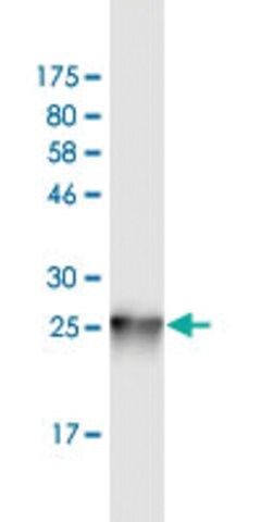 Monoclonal Anti-EMP3 antibody produced in mouse