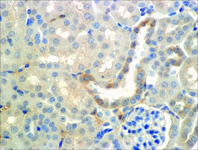 Monoclonal Anti-ENaC beta antibody produced in mouse