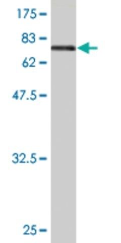 Monoclonal Anti-ENO1 antibody produced in mouse