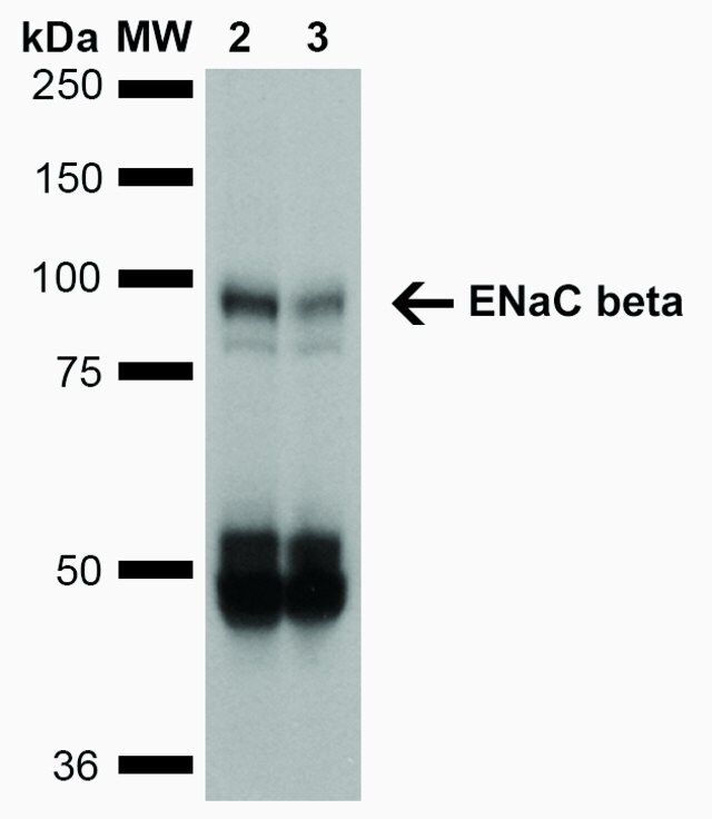 Monoclonal Anti-ENaC beta-R-Phycoerythrin antibody produced in mouse