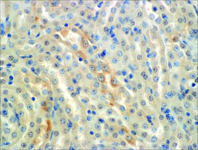 Monoclonal Anti-ENaC alpha-Horseradish Peroxidase antibody produced in mouse