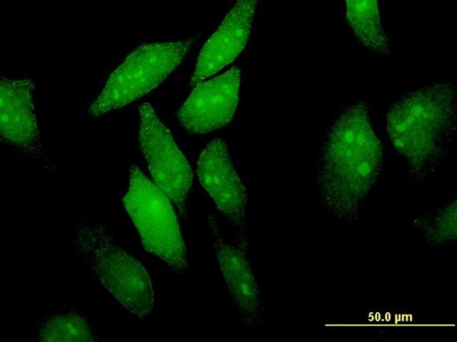 Monoclonal Anti-EIF4ENIF1, (C-terminal) antibody produced in mouse