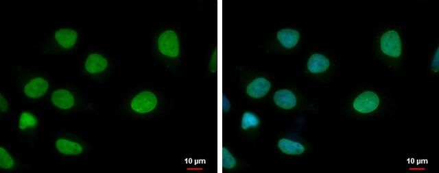 Monoclonal Anti-ELP3 antibody produced in mouse