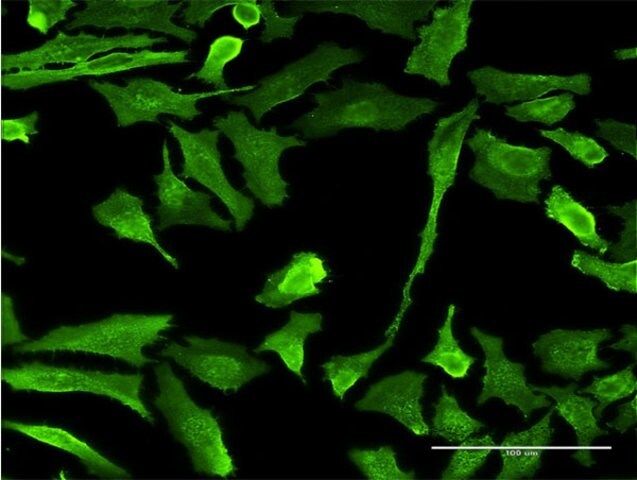 Monoclonal Anti-EMR4P antibody produced in mouse