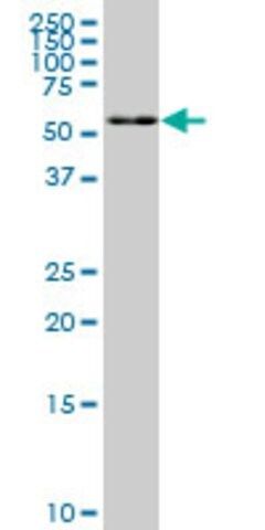 Monoclonal Anti-FAAH, (C-terminal) antibody produced in mouse