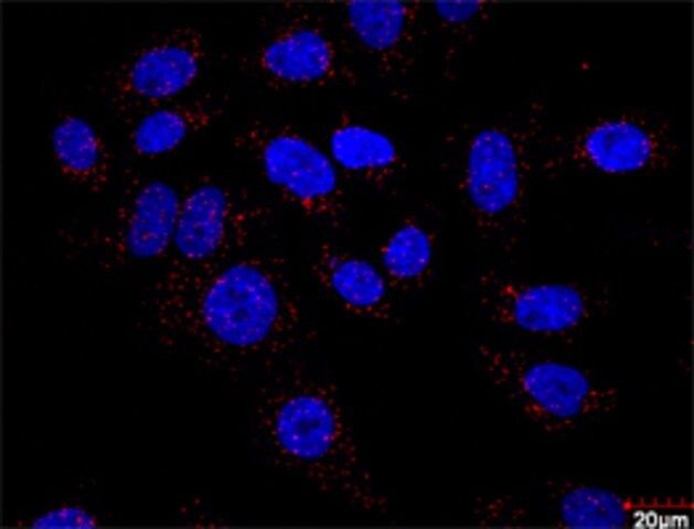 Monoclonal Anti-F13A1 antibody produced in mouse