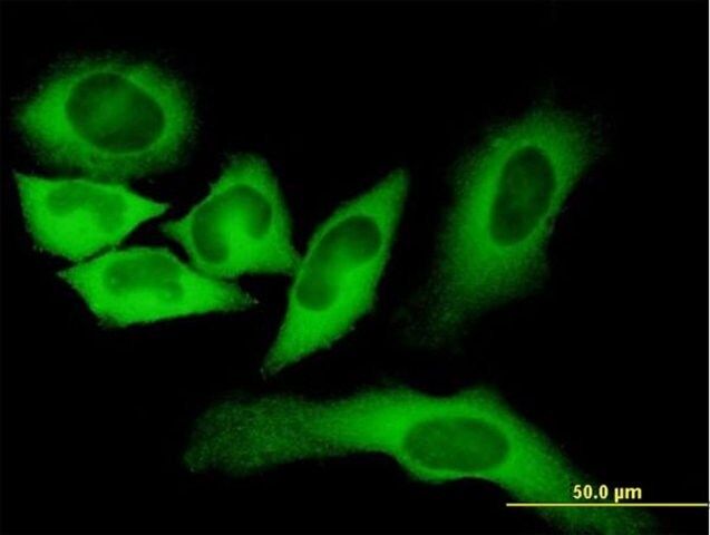 Monoclonal Anti-FASN antibody produced in mouse