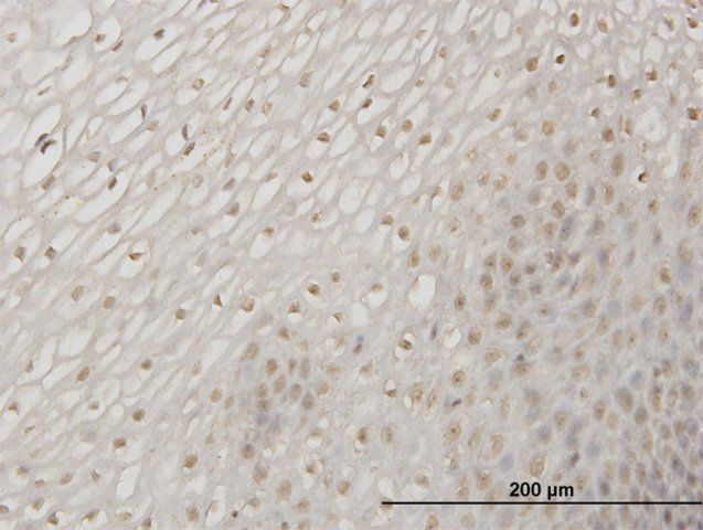 Monoclonal Anti-ERN1 antibody produced in mouse