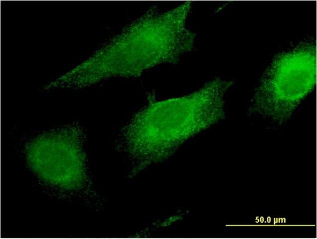 Monoclonal Anti-FAIM2 antibody produced in mouse