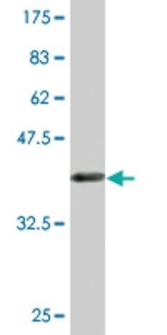 Monoclonal Anti-FANCB, (C-terminal) antibody produced in mouse