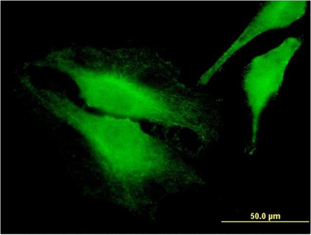 Monoclonal Anti-FARP1 antibody produced in mouse