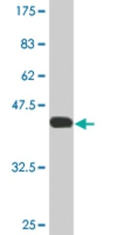 Monoclonal Anti-FABP4 antibody produced in mouse