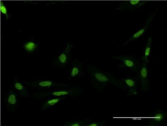 Monoclonal Anti-FASTK antibody produced in mouse