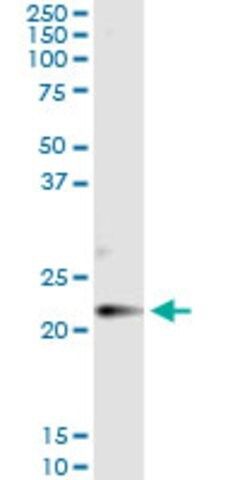 Monoclonal Anti-CLDN14 antibody produced in mouse