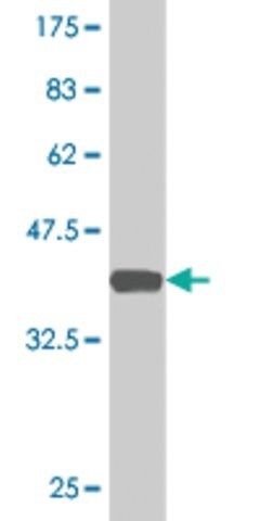 Monoclonal Anti-CLIC3, (C-terminal) antibody produced in mouse