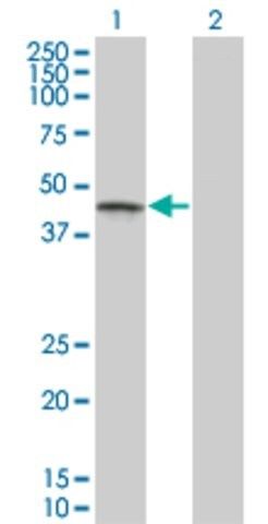 Monoclonal Anti-CSNK1G1 antibody produced in mouse