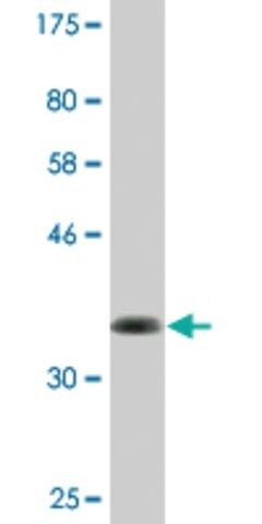 Monoclonal Anti-ABI3BP antibody produced in mouse