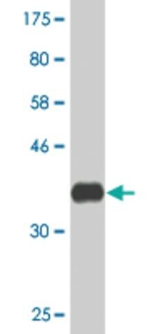 Monoclonal Anti-ABCC5 antibody produced in mouse