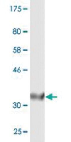 Monoclonal Anti-ACOX2, (C-terminal) antibody produced in mouse