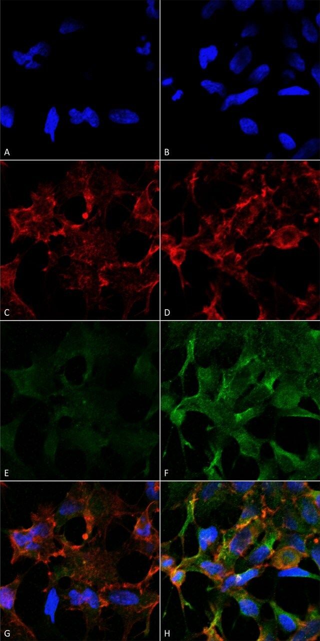 Monoclonal Anti-Acrolein antibody produced in mouse