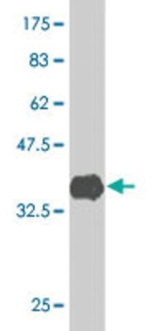 Monoclonal Anti-ACVR1B antibody produced in mouse