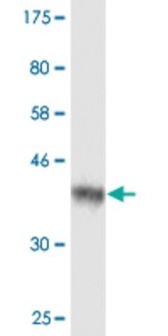 Monoclonal Anti-AIP antibody produced in mouse