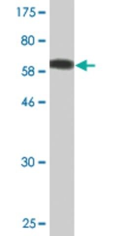 Monoclonal Anti-AKR7A2 antibody produced in mouse