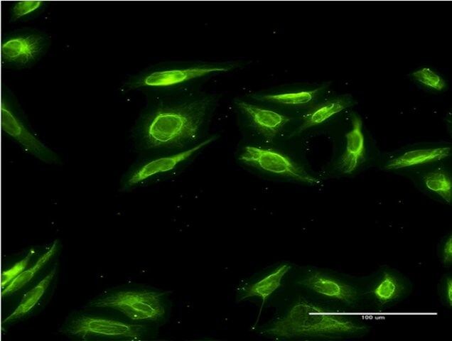 Monoclonal Anti-AKR1B10 antibody produced in mouse