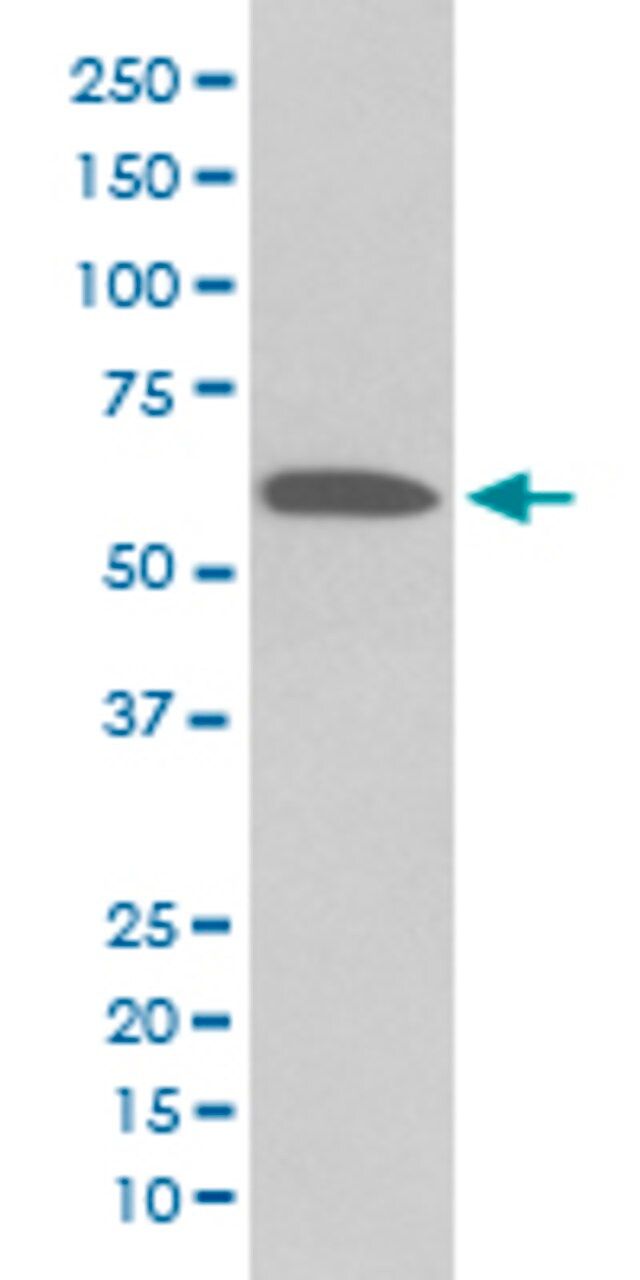 Monoclonal Anti-AKT1 (phospho S473) antibody produced in rabbit