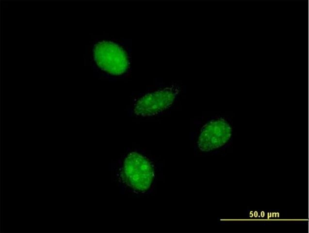 Monoclonal Anti-ALF antibody produced in mouse