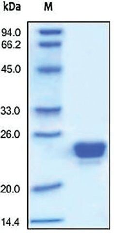 Lipocalin-2/LCN2 human