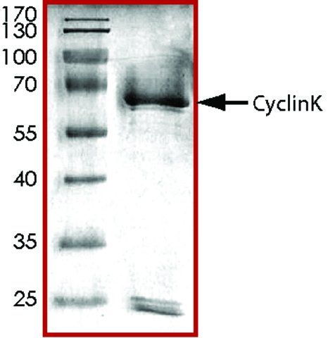 CyclinK, GST tagged human