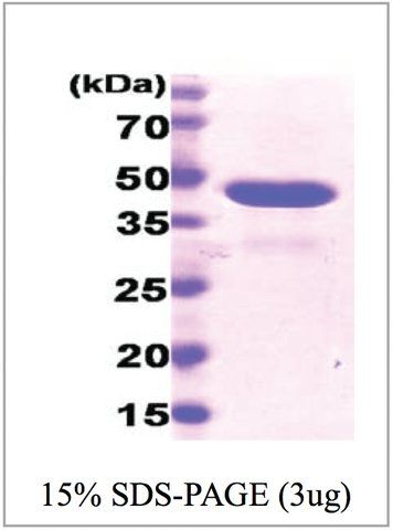 Cyclophilin D human