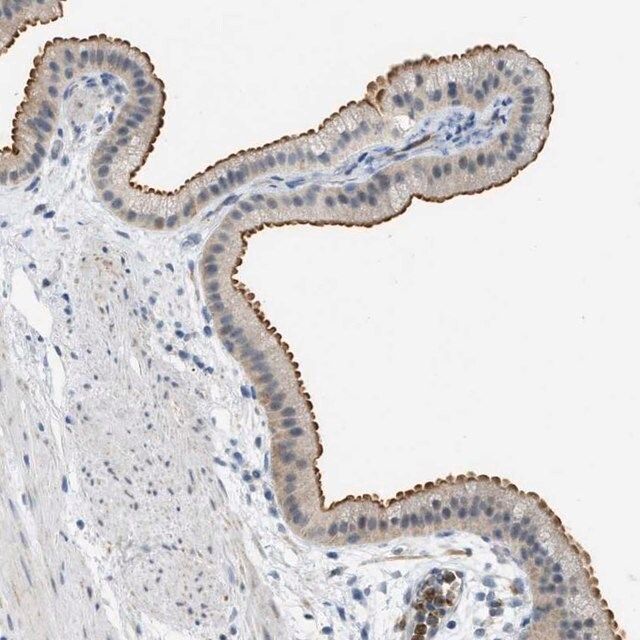 Anti-ZNF408 antibody produced in rabbit