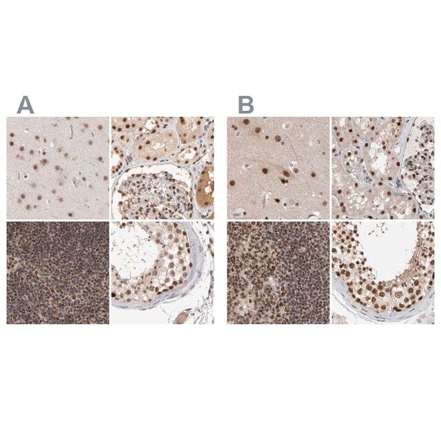 Anti-ZNF830 antibody produced in rabbit